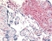 DPP4 Antibody