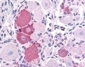TRPV2 Antibody