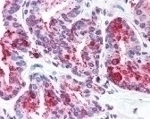 WNT5B Antibody
