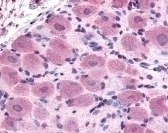 TRPA1 Antibody