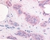KDR Antibody