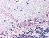 PTGER3 Antibody