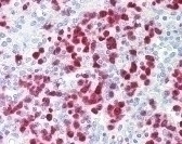 Calgranulin A Antibody [CF-145]
