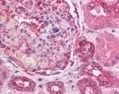 ATM Antibody [3E8]