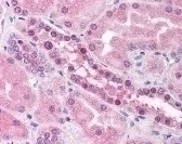 RAD54L Antibody [60.1]