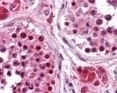 Replication Protein A3 Antibody [111]