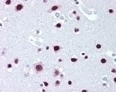 SAFB Antibody [6F7]