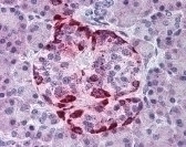 EPHA2 Antibody