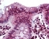 FOXC1 Antibody