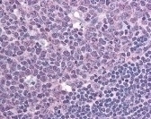 CXCR7 Antibody