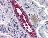 Aquaporin 2 Antibody