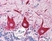 SLC15A1 Antibody