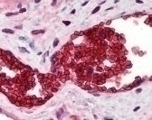SLC4A1 Antibody