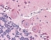 SLC6A3 Antibody