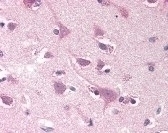 SMOC2 Antibody