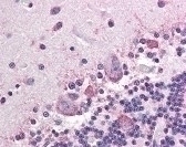 ALPP Antibody [H7E8]
