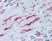 Integrin beta 2 Antibody [MEM-48]