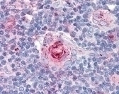 ICAM1 Antibody [MEM-111]