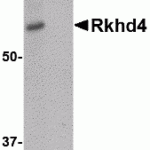 Western blot analysis of Rkhd4 in SK-N-SH cell lysate with Rkhd4 antibody at 1 μg/mL in (A) the absence and (B) the presence of blocking peptide.