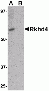 Rkhd4 Peptide