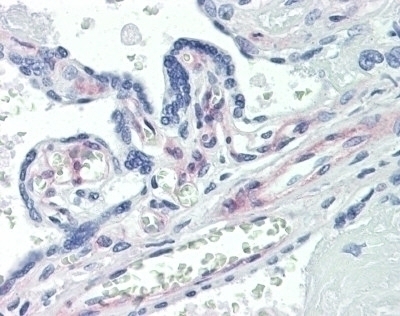 PDGFR Antibody [42G12]