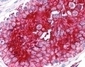 Basigin Antibody [MEM-M6/2]