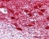 MAP2 Antibody [MT-08]