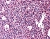 TNFSF13B Antibody [T7-241]