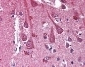 CXCR4 Antibody [12G5]