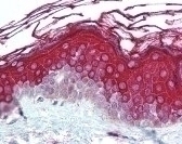 ALAS1 Antibody