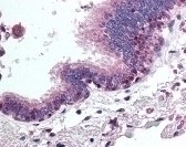 Histone Deacetylase 4 Antibody