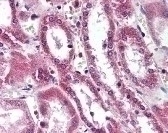 SIRT5 Antibody