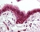 SKIL Antibody