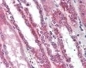 TMEM123 Antibody