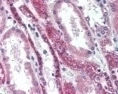TNFRSF11A Antibody