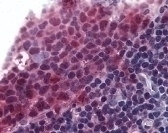 TNFSF13B Antibody
