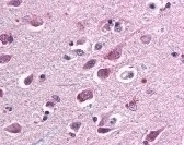 SARM1 Antibody [Sarmy-1]