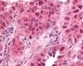 Early Growth Response 1 Antibody