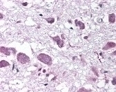 Prepro-orexin Antibody