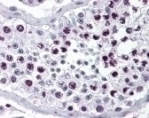 Cyclin A1 Antibody
