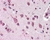 Cullin 7 Antibody