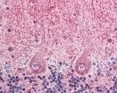EIF3F Antibody