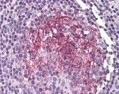 IL-1 Receptor Type 2 Antibody
