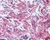 MYL9 Antibody