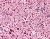 Neurofibromin 2 (phospho Ser518) Antibody