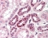 NOTCH2 Antibody