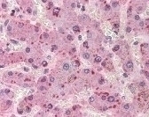 ORM1 Antibody