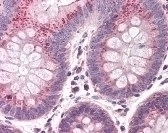 Cullin 9 Antibody