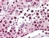 SPANXC Antibody