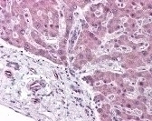 PPARA Antibody